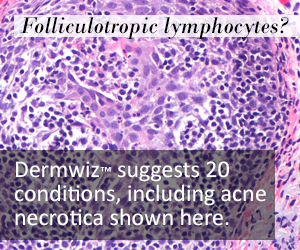 Dermwiz ad 1 300x250