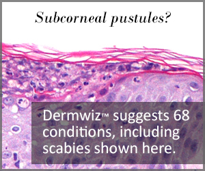 Dermwiz ad 2 300x250